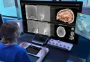 Philips Awarded ARPA-H Grant to Advance AI-Enabled Robotic Stroke Care